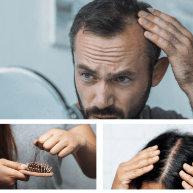 Photodynamic Therapy for Skin Cancer Explained: How Light Treats Abnormal Cells