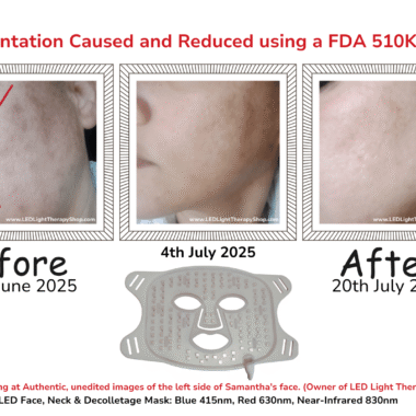 Red Light Therapy: What It Is and Does It Really Work?