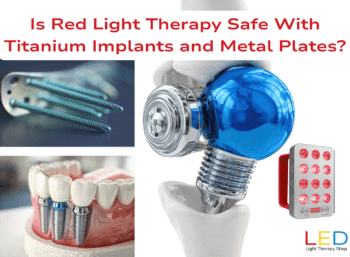 Is Red Light Therapy Safe With Titanium Implants and Metal Plates Illustration showing titanium screws, dental implants, and a hip joint implant alongside a red LED light therapy panel, with text asking ‘Is Red Light Therapy Safe With Titanium Implants and Metal Plates?’ from LED Light Therapy Shop.