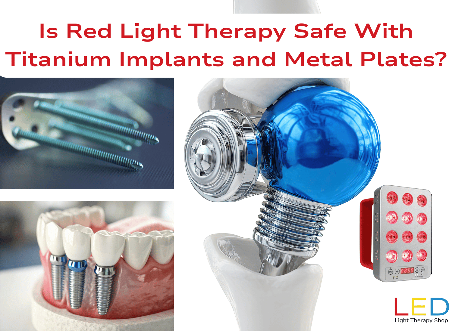 Is Red Light Therapy Safe With Titanium Implants and Metal Plates Illustration showing titanium screws, dental implants, and a hip joint implant alongside a red LED light therapy panel, with text asking ‘Is Red Light Therapy Safe With Titanium Implants and Metal Plates?’ from LED Light Therapy Shop.