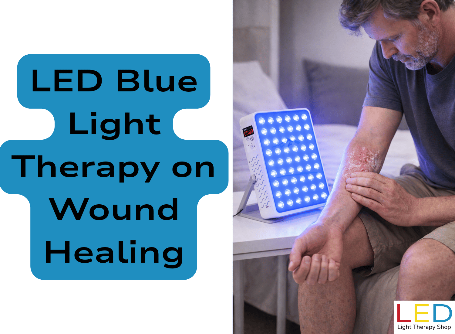 Blue Light Therapy LED blue light therapy on wound healing graphic showing a man using a tabletop blue LED panel with a red digital timer display to shine blue light onto an inflamed, scaly forearm area, alongside large text reading ‘LED Blue Light Therapy on Wound Healing’, with LED Light Therapy Shop branding.
