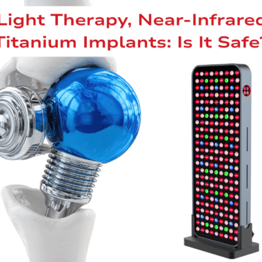 Red Light Therapy, Near‑Infrared and Titanium Implants: Is It Safe?